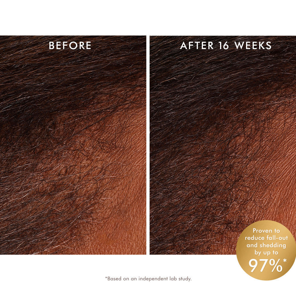 Moroccanoil Revitalizing Scalp Tonic 100ml