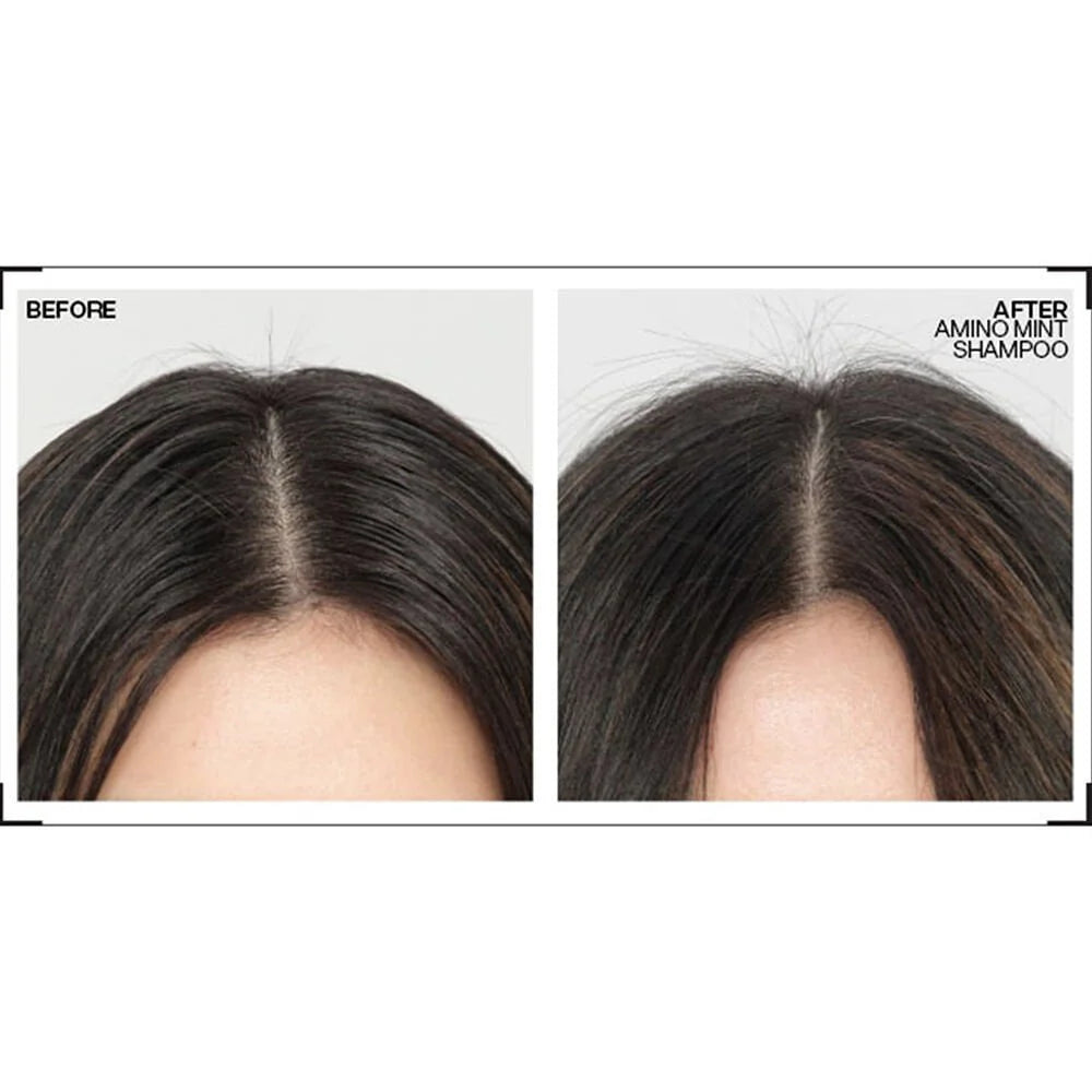 REDKEN Amino-Mint Scalp Shampoo 1000ml