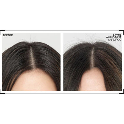 REDKEN Amino-Mint Scalp Shampoo 1000ml